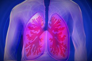 A tüdőfibrózis első jele a nehézlégzés és a száraz köhögés